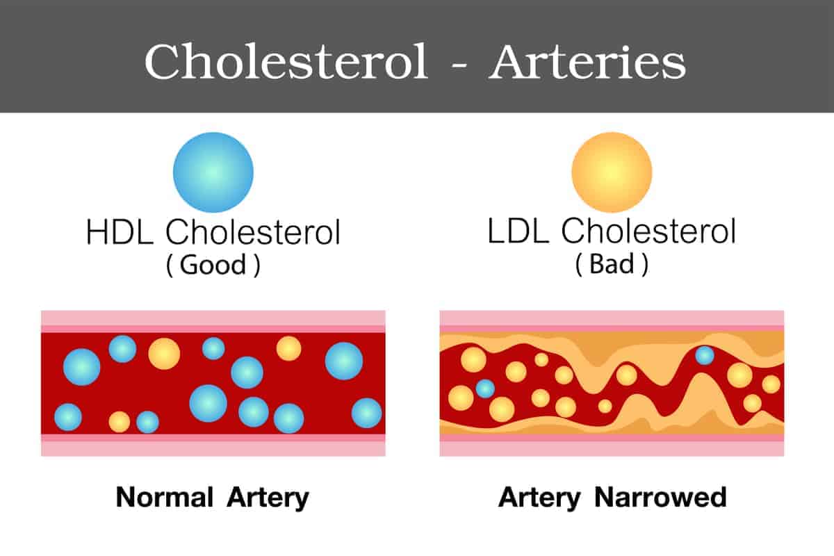 Cholesterol Infographic